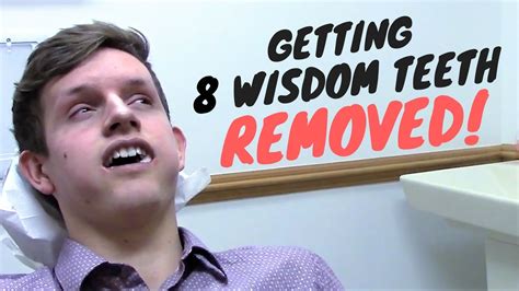 the wisdom teeth guys|THE WISDOM TEETH GUYS